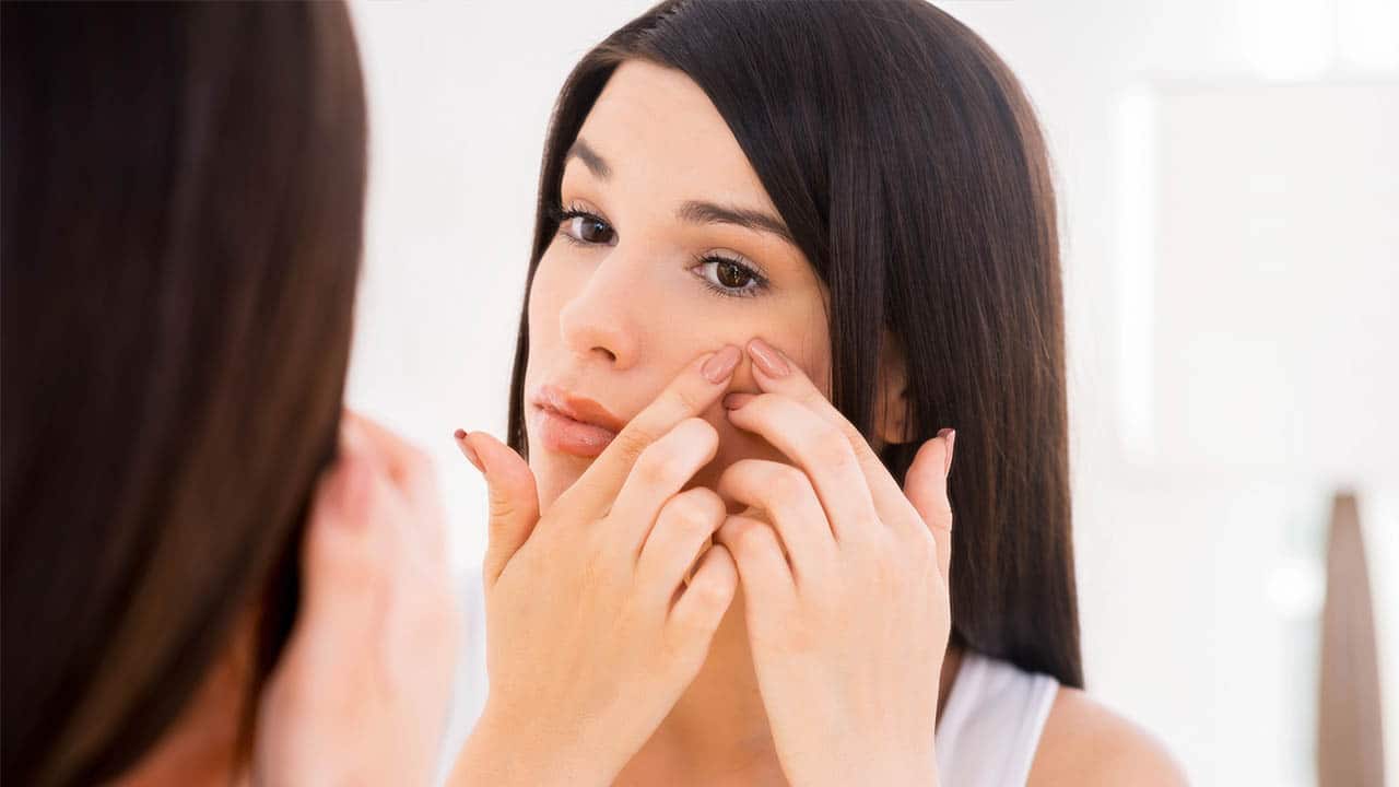 העלמת צלקות אקנה בקלות