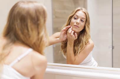 העלמת צלקות אקנה